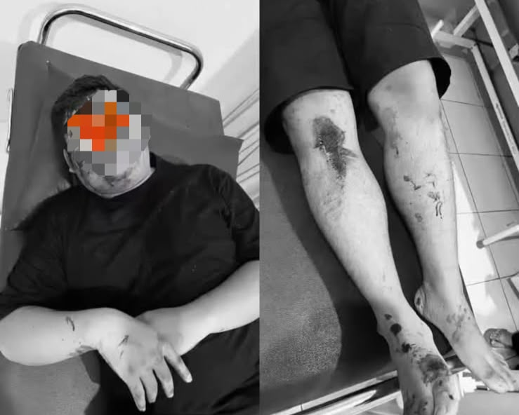 Diserang Sekelompok OTK di Benjeng Gresik, Kepala 2 Pengendara Terluka Dipukul Balok Kayu