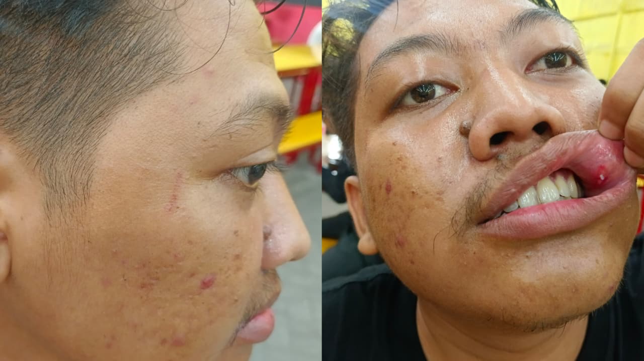 Kasus Penganiayaan Jurnalis Mangkrak di Polrestabes Surabaya