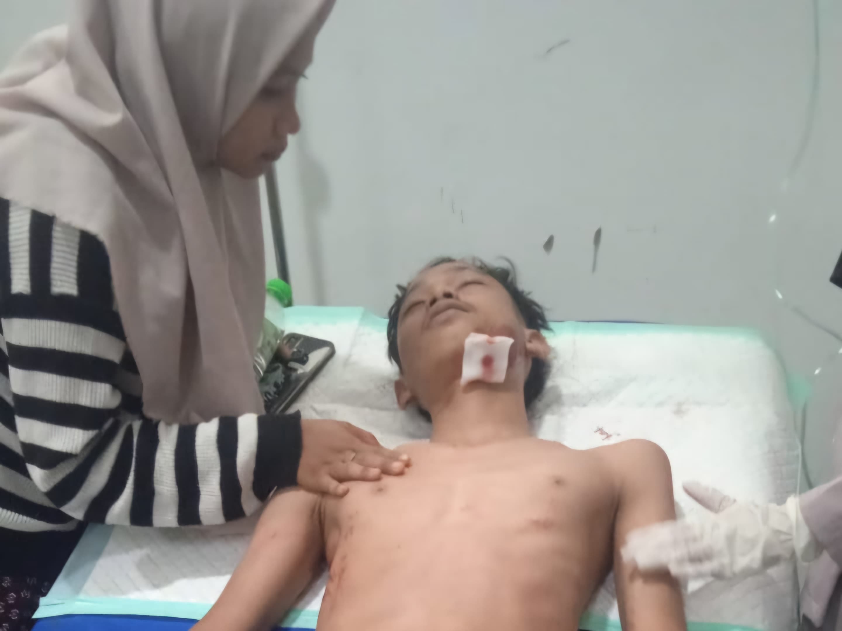 Remaja di Pasuruan Terjatuh ke Sumur Sedalam 25 Meter, Dilarikan ke RSUD Bangil