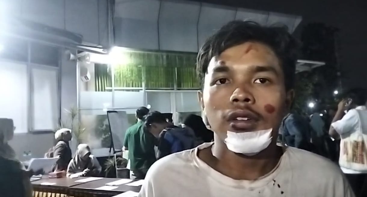 Begini Kesaksian Korban Selamat Tragedi Runtuhnya Bangunan Ponpes Al Khoziny Sidoarjo