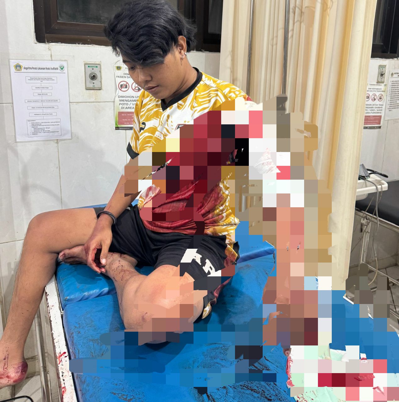 Gangster Berulah di Driyorejo: Pelanggan Warung Dibacok, Rumah Warga Dilempari Batu