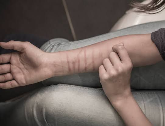 Tangkal Self Harm, Anak-anak Harus Didampingi ketika Ada Masalah