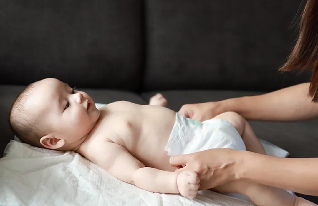 7 Cara Mengatasi Ruam Kulit pada Bayi