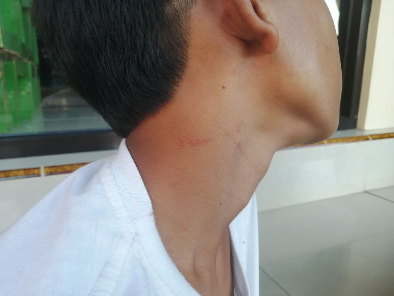 Berdalih Balap Liar, Oknum Polisi Polres Situbondo Aniaya dan Peras 5 Anak di Bawah Umur