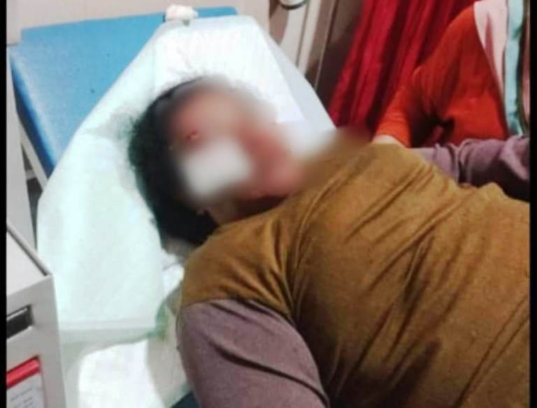 Ibu Rumah Tangga di Situbondo Diduga Jadi Korban Begal