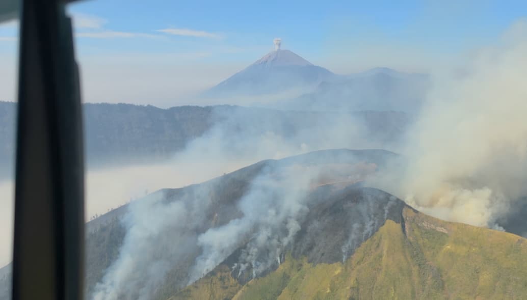 Relawan Korban Karhutla Bromo Jalani Operasi di RSUD Dr Soetomo