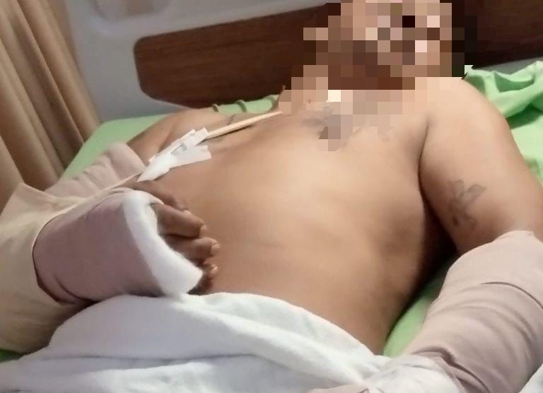 Sedang Bersama Ibu di Ruang Tamu, Warga Menganti Dibacok Celurit Tetangga Sendiri
