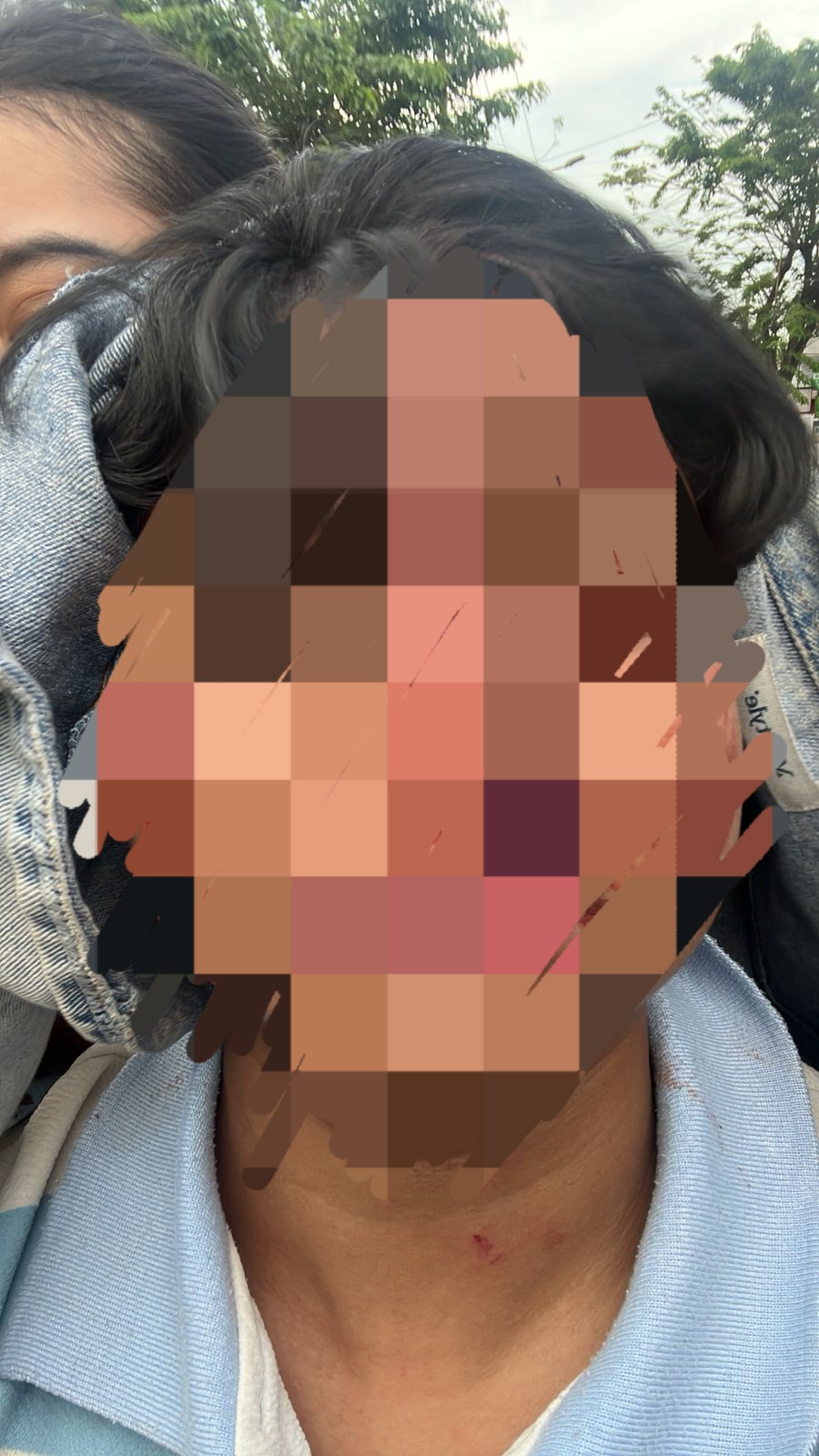 Pasangan Lesbi Dianiaya, Tak Terima Pacaran dengan Cowok