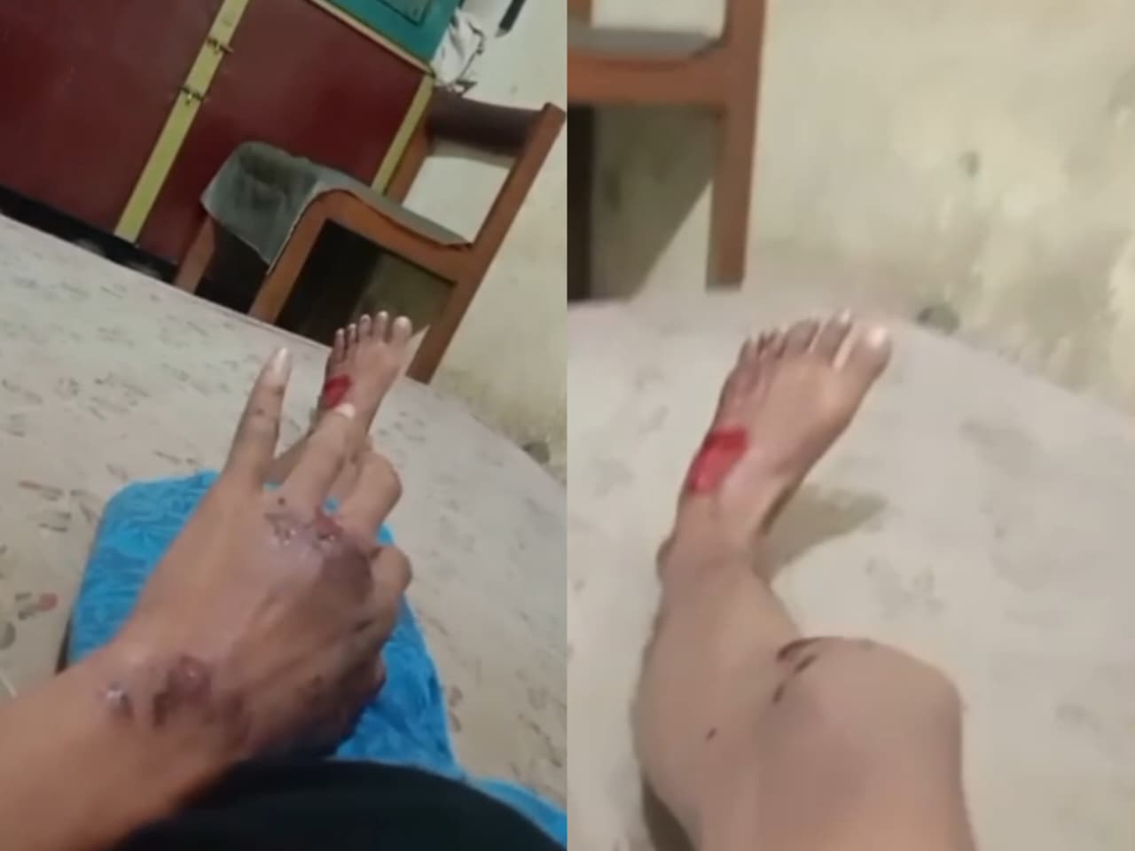 Pulang Kerja, Warga Gembong Dikeroyok Gangster Bersajam