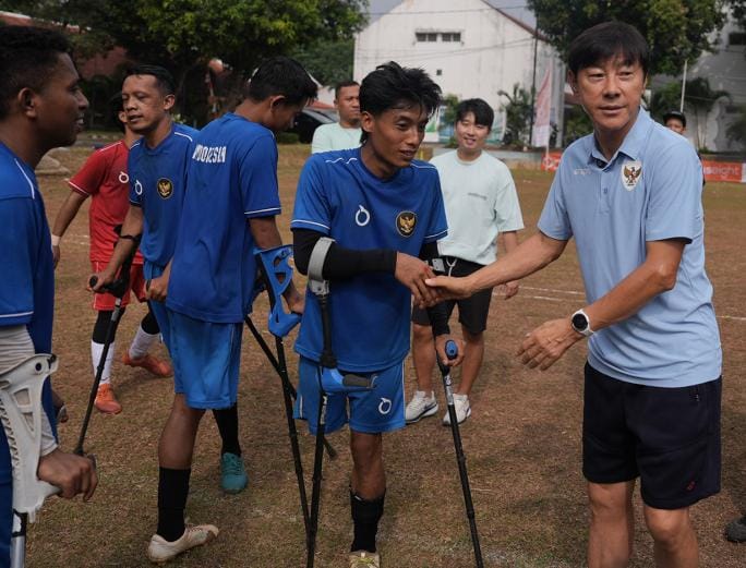 Hadir di Latihan Timnas Amputasi, STY Undang Pemain Nonton Langsung ke GBK