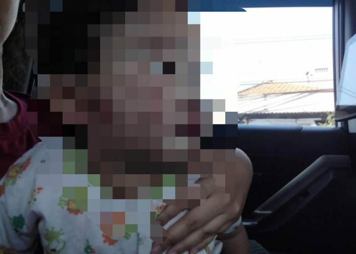 Balita Sidoarjo Diduga Digigit Teman Saat Dititipkan di Daycare, Alami Luka di Sekujur Tubuh