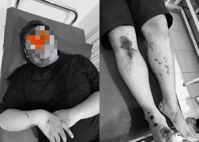 Diserang Sekelompok OTK di Benjeng Gresik, Kepala 2 Pengendara Terluka Dipukul Balok Kayu