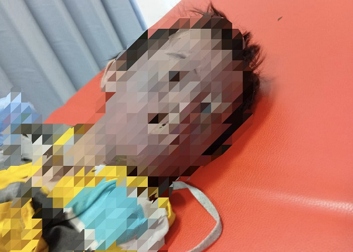 Keluarga Anak Down Syndrome Korban Bullying di Surabaya Kecewa, Minta Semua Pelaku Dibina