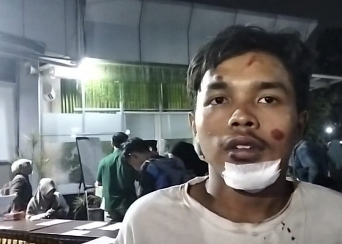 Begini Kesaksian Korban Selamat Tragedi Runtuhnya Bangunan Ponpes Al Khoziny Sidoarjo