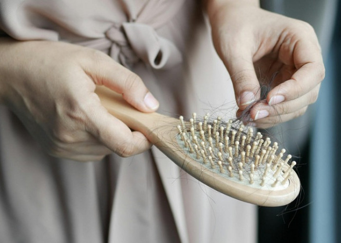 Rambut Rontok Secara Berlebihan, Ini yang Sering Jadi Penyebab