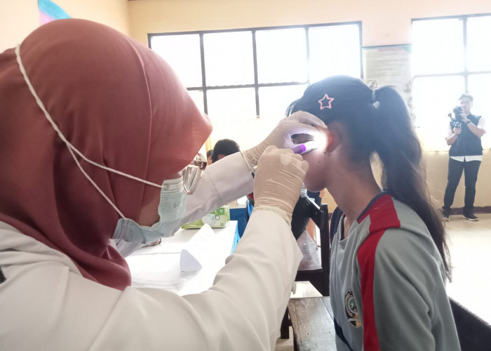 Ratusan Ribu Anak di Tulungagung Jadi Target Program PKG, Temuan Terbanyak Kelainan Visus