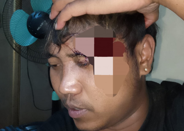 BPJS Tak Cover Biaya Korban Penganiayaan, LSM Gempar Minta Bantuan Bupati