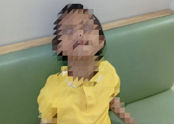 Tragis, Anak Down Syndrome di Rungkut Meninggal Diduga Jadi Korban Bullying Teman Sebaya