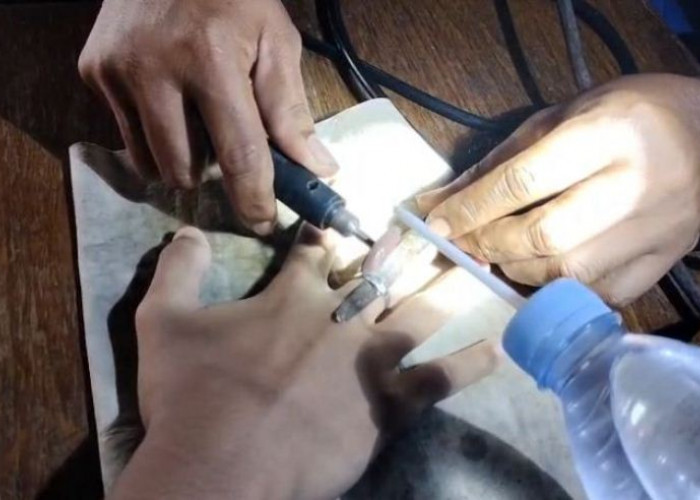 Cincin Tak Bisa Dilepas hingga Jari Bengkak, Remaja Gresik Dievakuasi Damkar