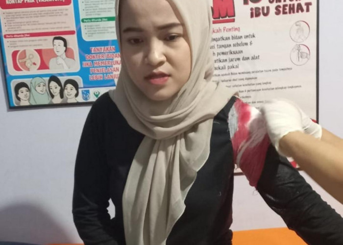 Begal Sadis Bacok Dua Wisatawan Wanita di Pasuruan, Jatanras Polda Jatim Turun Tangan