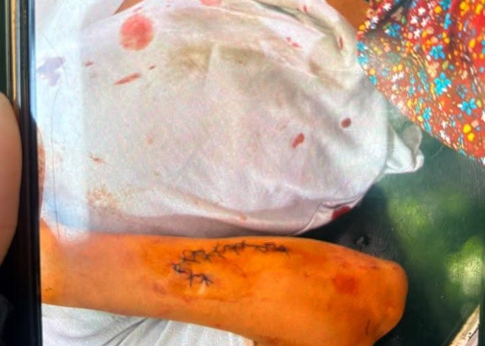 Penganiayaan Juru Parkir Tegalsari, Polisi terus Buru Pelaku