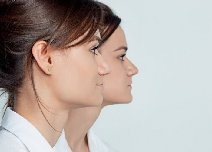 Membaca Pikiran dari Hidung? Pelajari Bagaimana Bentuk Hidung Mencerminkan Kepribadian
