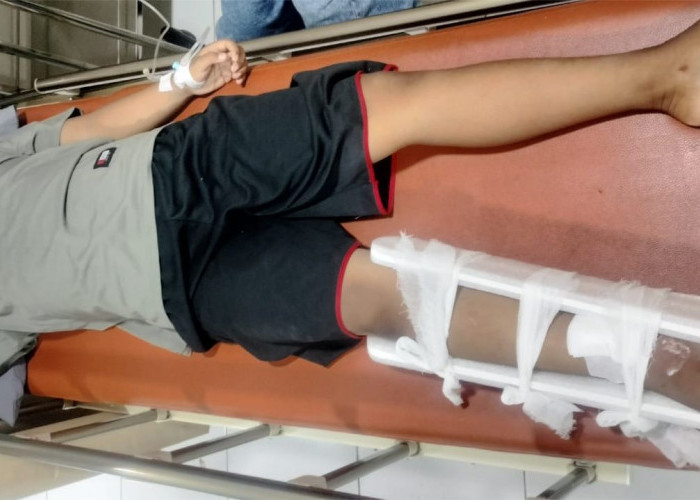 Nyeberang Tiba-tiba, Bocah Lelaki di Driyorejo Patah Kaki Tertabrak Motor Listrik