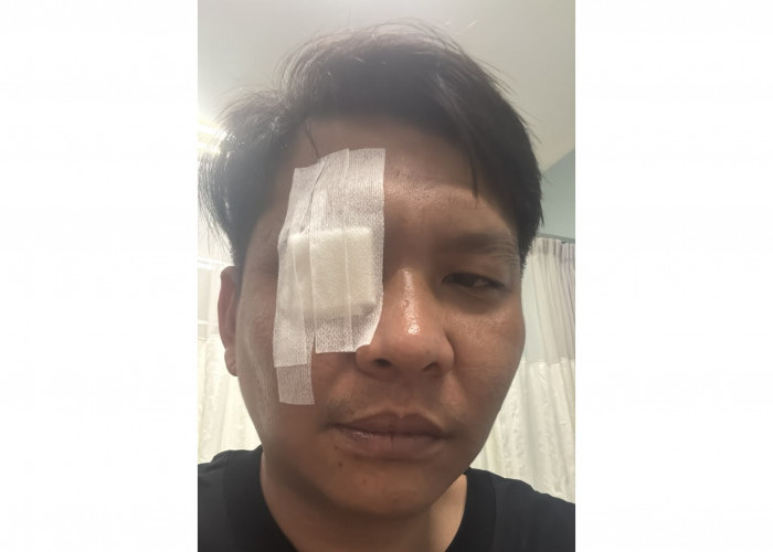 Gegara Kata Annyeonghaseyo, Pria Jaksel Dikeroyok dan Berujung Lapor Polrestabes Surabaya