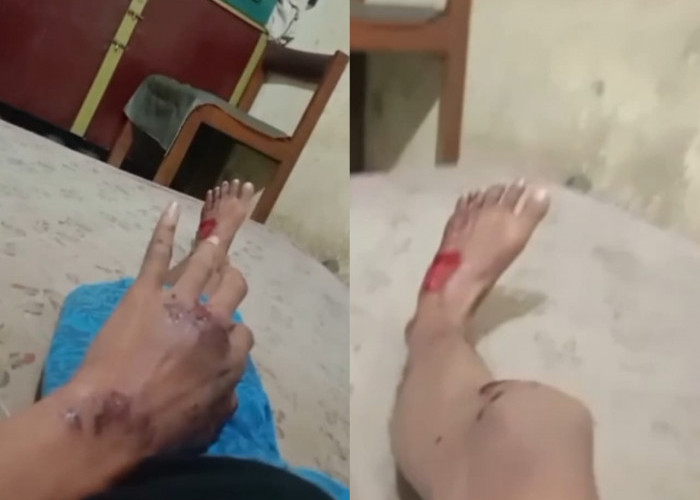 Pulang Kerja, Warga Gembong Dikeroyok Gangster Bersajam