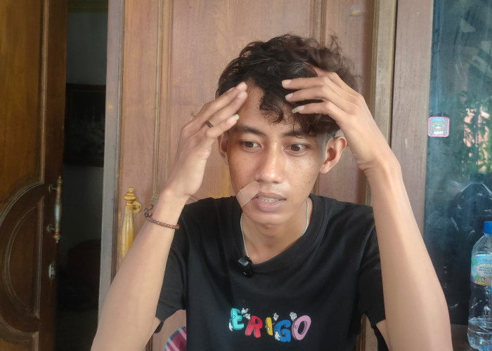 Karyawan Potong Rambut di Lidah Kulon Surabaya Dianiaya OTK, Bibir Robek