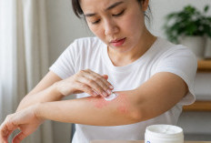 Cara Alami Atasi Gatal Kulit, Simak Tips Ampuh Ini