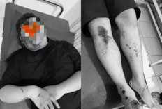 Diserang Sekelompok OTK di Benjeng Gresik, Kepala 2 Pengendara Terluka Dipukul Balok Kayu