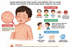 Kabupaten Gresik Diserang Campak, Ada 65 Kasus dalam Tiga Bulan