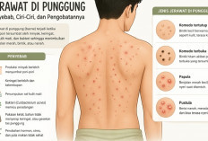 Jerawat Punggung Tidak Kunjung Hilang? Ini Penyebab dan Solusinya