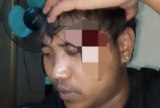 BPJS Tak Cover Biaya Korban Penganiayaan, LSM Gempar Minta Bantuan Bupati