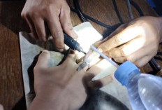 Cincin Tak Bisa Dilepas hingga Jari Bengkak, Remaja Gresik Dievakuasi Damkar