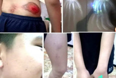 Diduga Dianiaya Oknum Tim Respatti Polrestabes Surabaya, Remaja Bronggalan Lapor Propam Polda Jatim