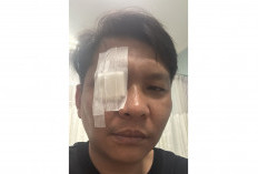 Gegara Kata Annyeonghaseyo, Pria Jaksel Dikeroyok dan Berujung Lapor Polrestabes Surabaya