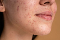 Tak Hanya Skincare, Ini 8 Cara Merawat Kulit dari Dalam agar Sehat dan Glowing