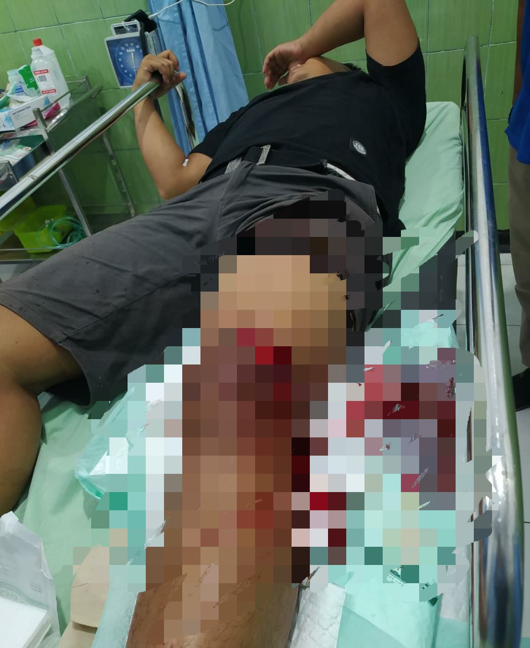 Tiga Pemuda Gresik Jadi Korban Pengeroyokan, Satu Terluka Bacok