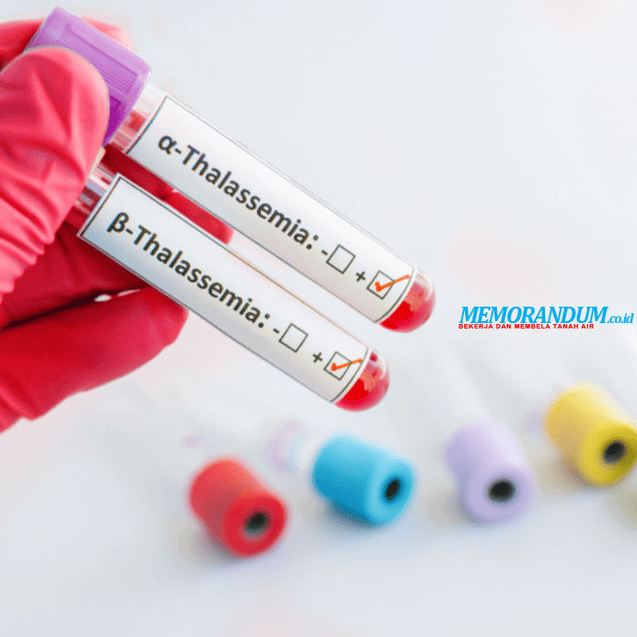 Penyakit Thalassemia Belum Bisa Disembuhkan, Namun Bisa Dicegah dengan Skrining