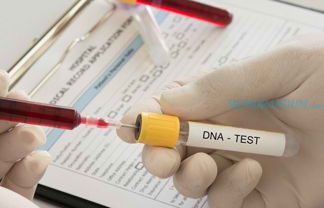 Tes DNA, Ketahui Beragam Jenisnya, Manfaat dan Cara Pengambilan Sampel