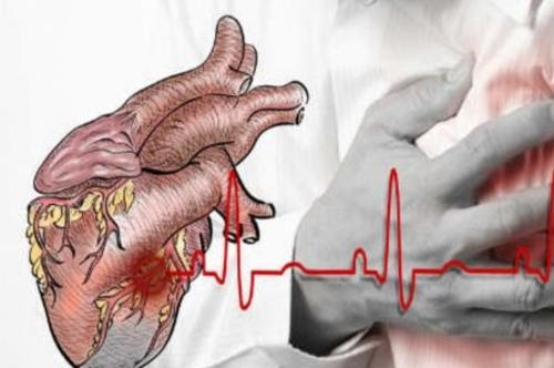 Cegah Resiko Penyakit Jantung dengan Pola Hidup Sehat